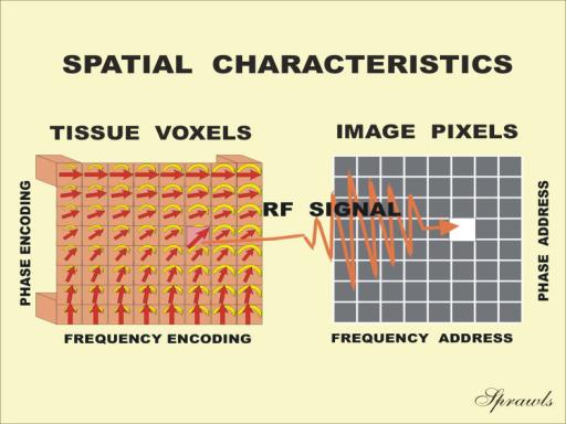 Magnetic Resonance Imaging